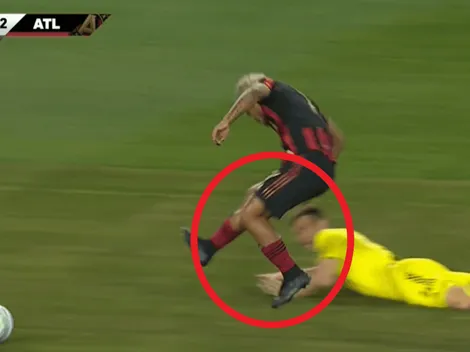 Video: la dolorosa lesión que sufrió figura de la Selección de Venezuela