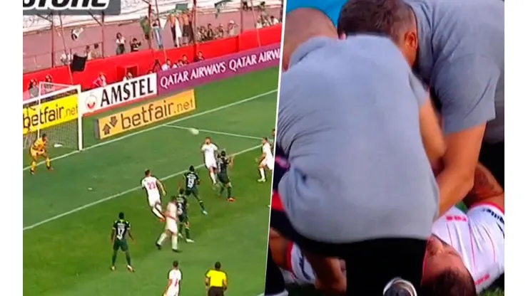 Video: Grimi hizo un gol con el hombro dislocado