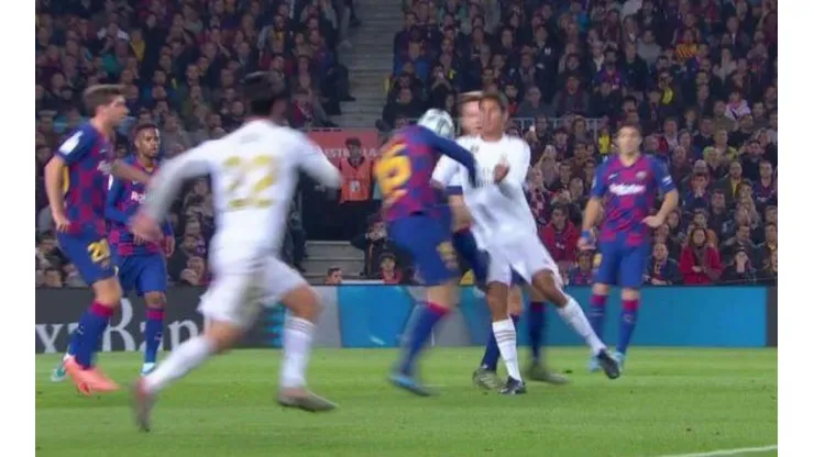 Así quedó la pierna a Varane después de la plancha de Lenglet