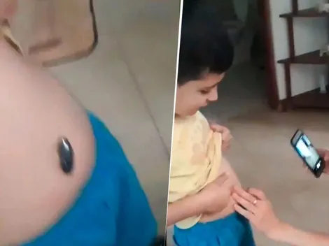 Video viral: nene se tragó un imán y su familia encontró una solución diabólica