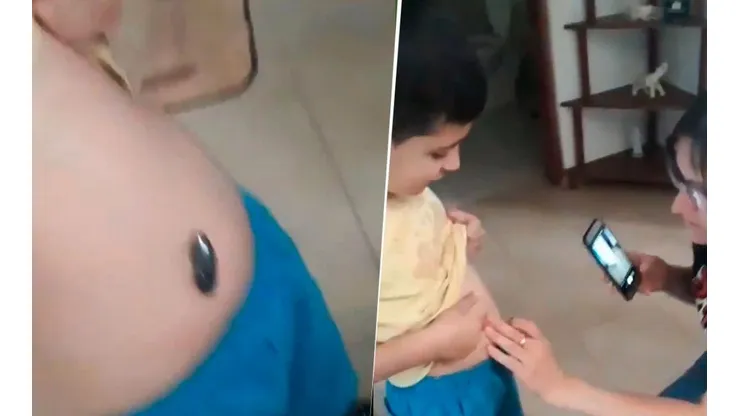 Video viral: nene se tragó un imán y su familia encontró una solución diabólica