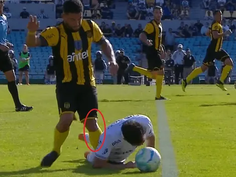 ¡Qué dolor! Ex Monterrey sufre una dura lesión en el Clásico uruguayo