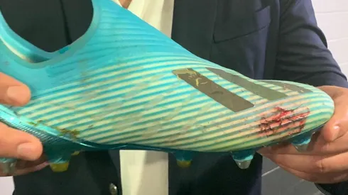 Así quedó el guayo de Ánderson Santamaría tras el duro golpe de Yerry Mina.