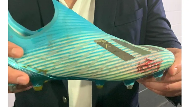 Así quedó el guayo de Ánderson Santamaría tras el duro golpe de Yerry Mina.