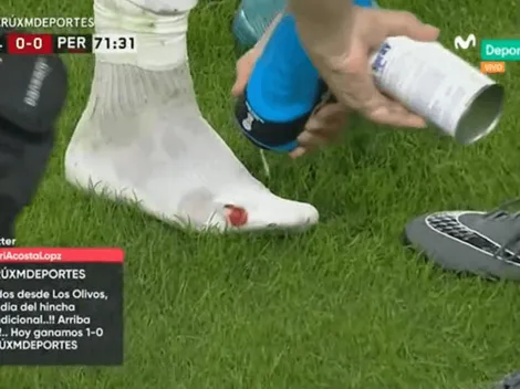 El botín de Anderson Santamaría quedó destrozado luego del choque con Mina