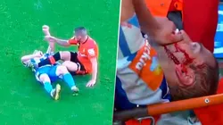 Video del golpe que sufrió Bergantiños.