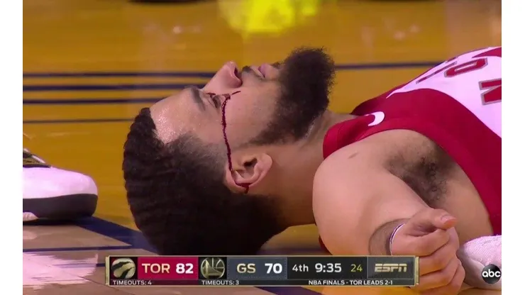 ¡Ouch! Le rompieron la cara a VanVleet con un terrible codazo en las Finales