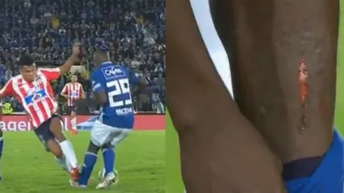 Así quedó la pierna de Elíser Quiñones luego de la entrada de Luis Díaz.