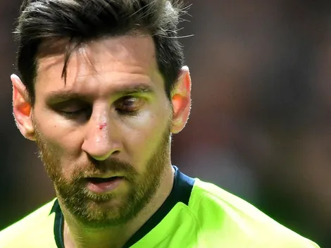 Lejos de pedirle perdón a Messi: Smalling no se arrepiente por lastimarle toda la cara