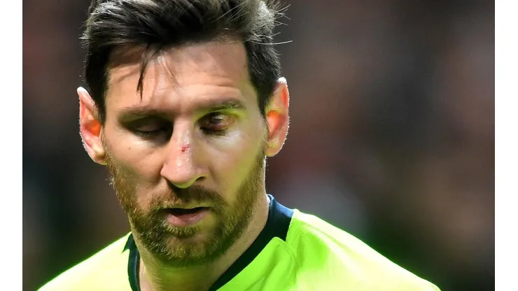 Así quedó el rostro de Lionel Messi.