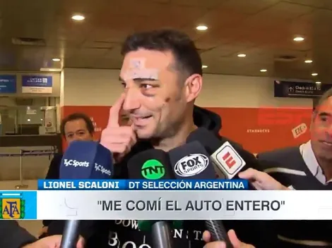 Scaloni llegó al país y, todo malherido, contó como fue el accidente