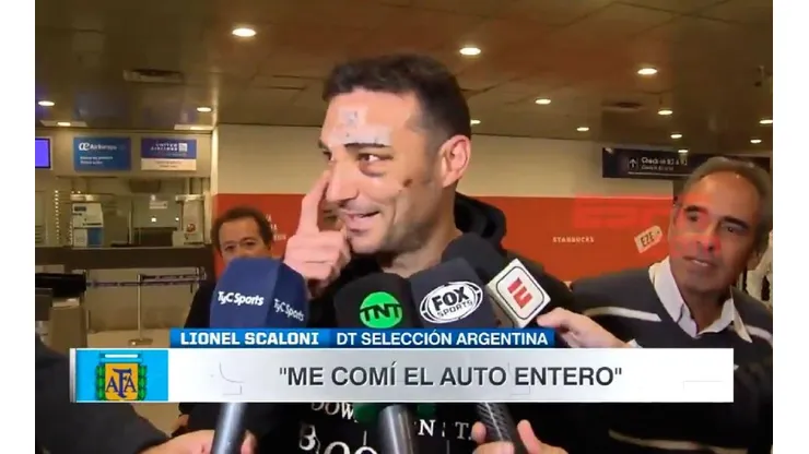 Scaloni llegó al país y habló de como fue su accidente.