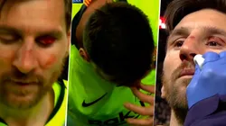 Lo arruinaron: a Messi le metieron un codazo en la cara y terminó sangrando
