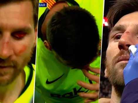 Lo arruinaron: a Messi le metieron un codazo en la cara y terminó sangrando
