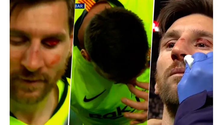 Lo arruinaron: a Messi le metieron un codazo en la cara y terminó sangrando