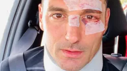 Scaloni mostró cómo quedó su rostro y escribió un mensaje de agradecimiento