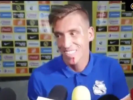 Vikonis mostró cómo le dejó el labio Nicolás Castillo