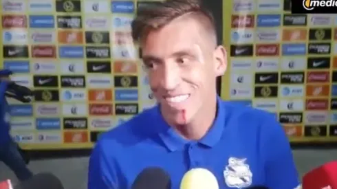 A Vikonis le cortaron el labio.