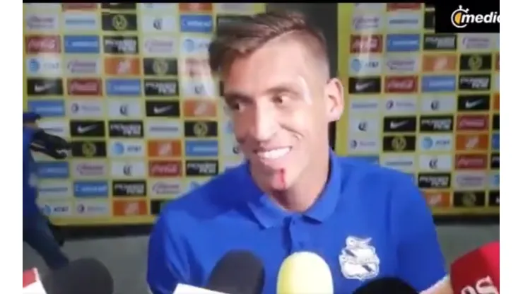 A Vikonis le cortaron el labio.