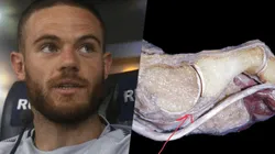 La lesión de Nández, explicada por el médico de Boca.