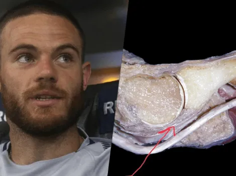 El médico de Boca explicó porque Nández todavía no volvió a jugar