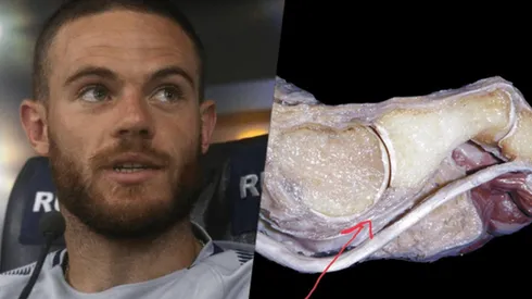 La lesión de Nández, explicada por el médico de Boca.