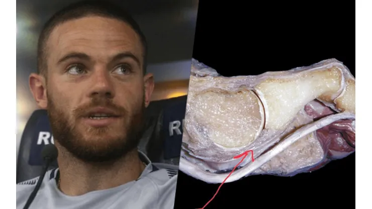 La lesión de Nández, explicada por el médico de Boca.
