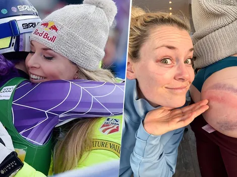¡Ella subió una foto de su cara y la cola de una amiga con unos moretones enormes!