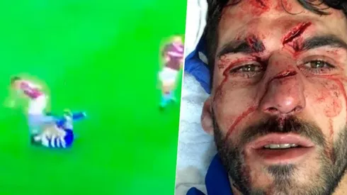 Oliveira y una brutal entrada.