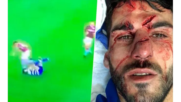 Oliveira y una brutal entrada.