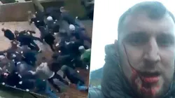 Así quedó la cara de un fanático del Everton.