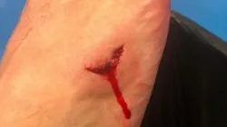 El pie de Máxi López luego del corte