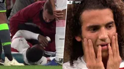 Duele verla: la grave lesión de Welbeck que conmocionó a todos