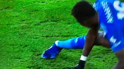 Durísima lesión de Amartey.