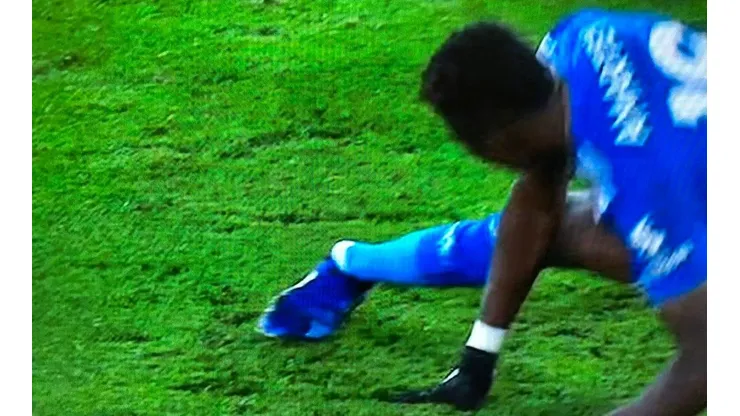 Durísima lesión de Amartey.