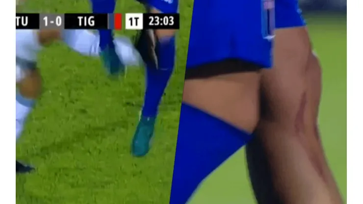 ¡Dolor!
