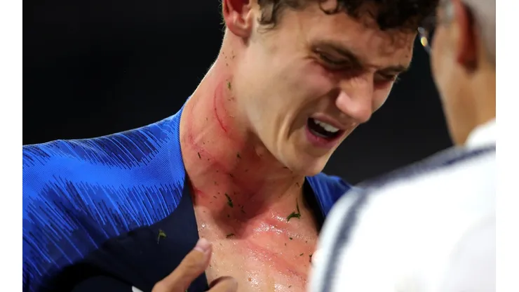 Foto de Pavard y las marcas en su cuello.