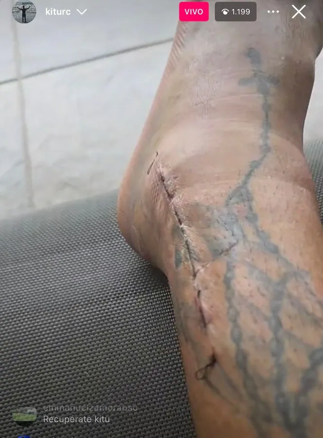 La impactante imagen de la lesión de Damián Díaz. (Foto: @kiturc)