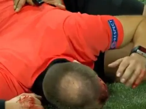 En la Europa League un aficionado le abrió la cabeza a un juez de línea con un proyectil