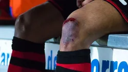 El ex Racing es retirado en camilla del estadio