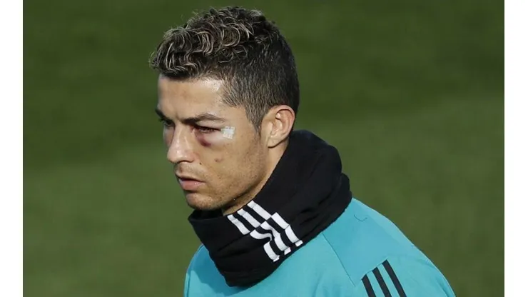 A Cristiano Ronaldo le quedaron secuelas en su ojo.