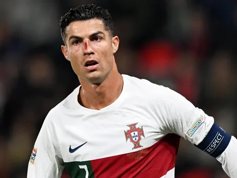 Susto en Portugal: tremendo golpe a Cristiano lo dejó ensangrentado