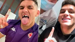 Selfie del antes y después del diente de Torreira.