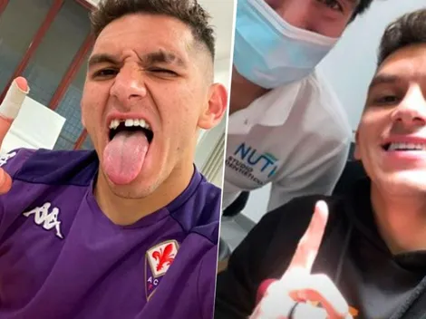 El antes y el después de la caída del diente de Lucas Torreira