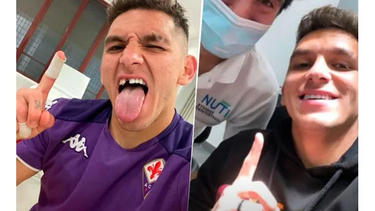 Selfie del antes y después del diente de Torreira.