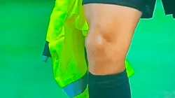 Banderín de la polémica.