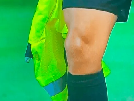 El banderín de un juez de línea en Chile vs Argentina, ¿era un chaleco reflectivo?