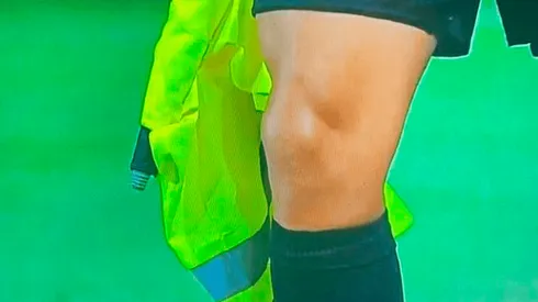 Banderín de la polémica.