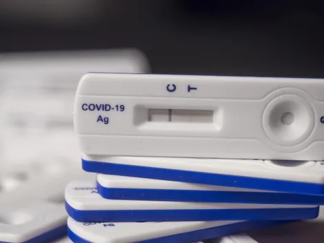 Coronavirus: cuáles son las diferencias entre un PCR y el test de antígenos para confirmar la enfermedad