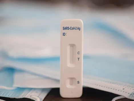 Precios de los test de antígenos en España: ¿Cuál será su valor máximo?